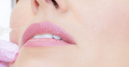 Mit einer Lippenaufspritzung  erhalten Sie volle und sinnliche Lippen nach nur einer Behandlung.